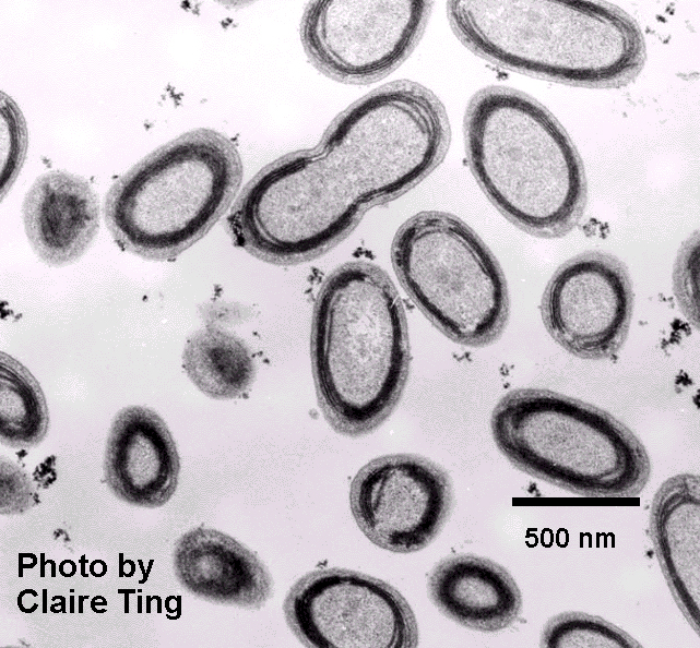 Prochlorococcus sections